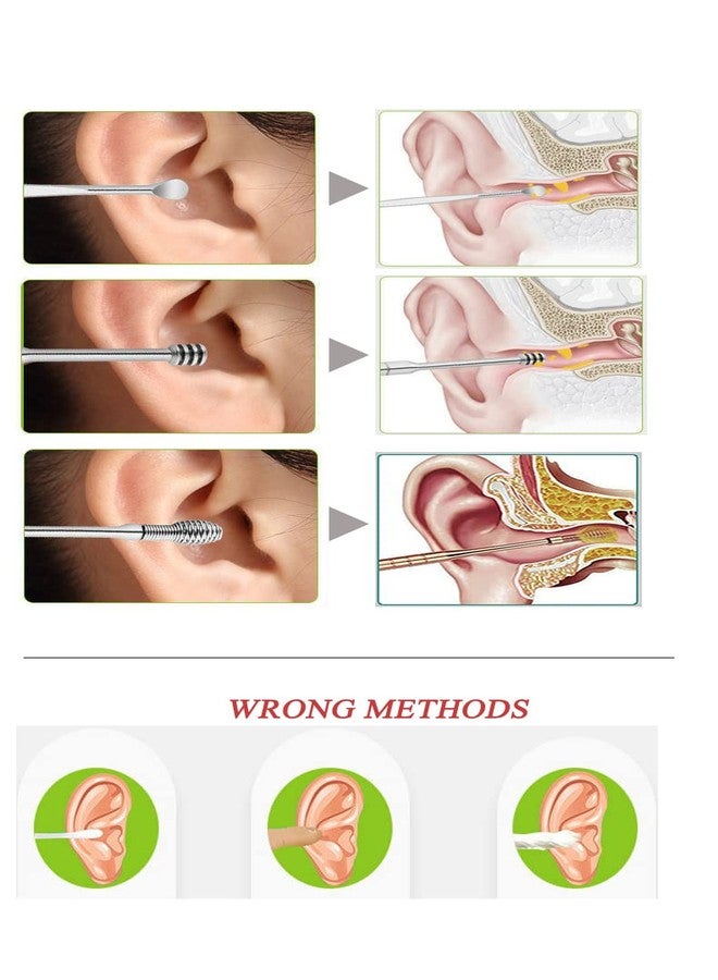 Nothers 8 Pcs Ear Pick Earwax Removal Kit, Ear Cleaning Tool Set, Ear Curette Ear Wax Remover Tool with Storage Box and Cleaning Brush - Image 5